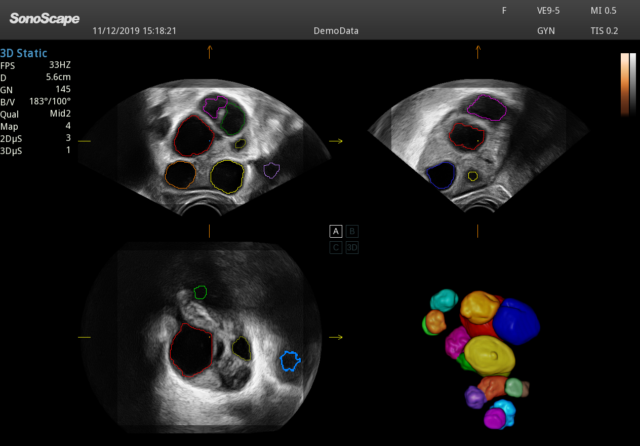 Echographe Premium Gynécologie Obstétrique SonoScape P40 Elite