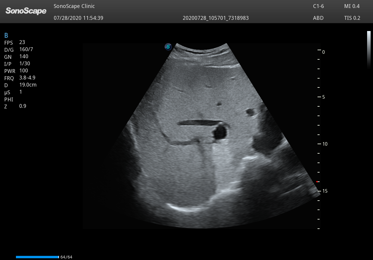 Echographe pour bloc opératoire
