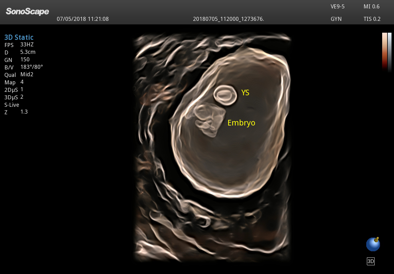Echographe Premium Gynécologie Obstétrique SonoScape P40 Elite